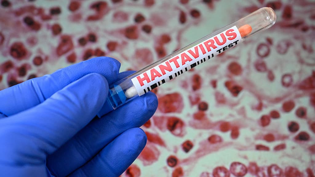 Colorado Confirms Hantavirus Death Unrelated to Cruise Outbreak