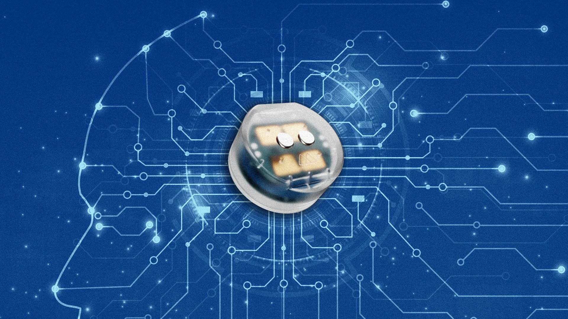 Brain Implant Breakthrough Opens New Mental Health Treatment Frontier